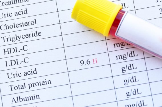 Các chỉ số thường dùng đánh giá kết quả Ngoại kiểm
