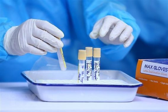 Hướng dẫn viết SOP về quản lý trong xét nghiệm